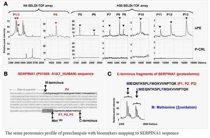 the urine proteomics profile of preeclampsia with biomarkers mapping to SERPINA1 sequ