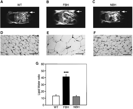 Fat BDNF heterozygous mutant (FBH) mice are obese and show adipocyte hypertrophy