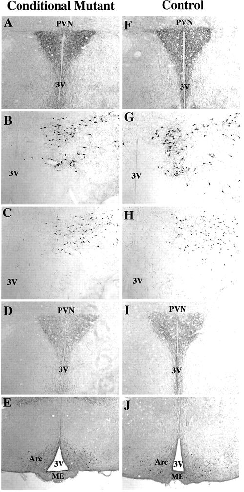 Immunohistochemical Analysis of the BDNF Conditional Mutant Hypothalamus