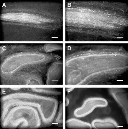 Photomicrographs of sections through the vas deferens, cauda, corpus, and caput of epididymis labeled with CART antisera using the fluorescent method. 