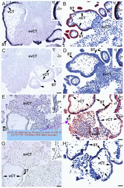 Sections of human FT placental tissue at week 6-10 of gestation showing the localization of KiSS-1/Kp-54 (A,B) and KiSS-1R (E,F)