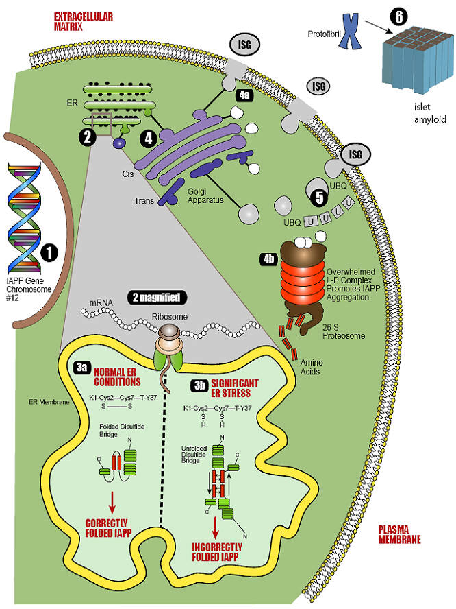 Islet amyloid polypeptide (IAPP) misfolding leads to protein aggregates.