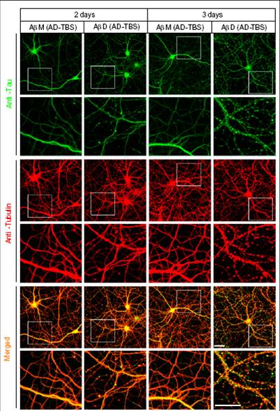 A marked degeneration of neurites after days of exposure, as indicated by extensively beaded, dystrophic neurites and an abnormal microtubule cytoskeleton revealed by Tubulin and tau immunocytochemistry