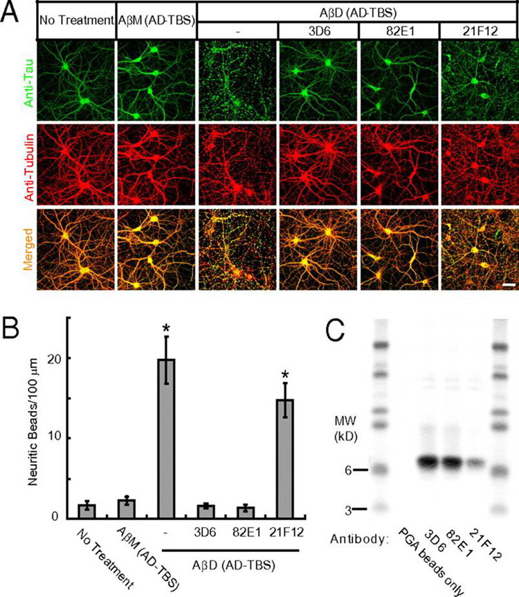 Immunological neutralization of the cytoskeletal alterations induced by human Aβ dimers.