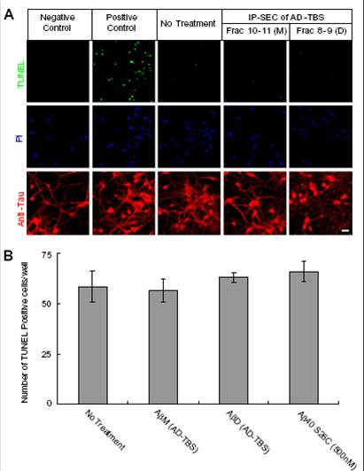 Although exposure to the Abdimers invariably disrupted the neuritic cytoskeleton, neuronal cell bodies generally survived the 3-d treatment, and there was no significant increase in the very low baseline levels