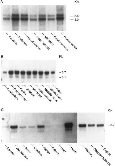 Northern blot analysis of the distribution of preproapelin mRNA in human 