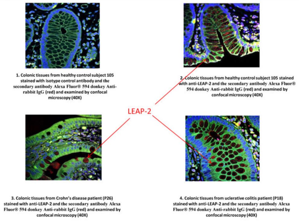 expression of LEAP-2 protein in the colonic tissue